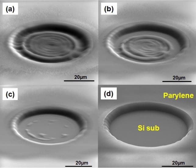 Excimer laser ablation