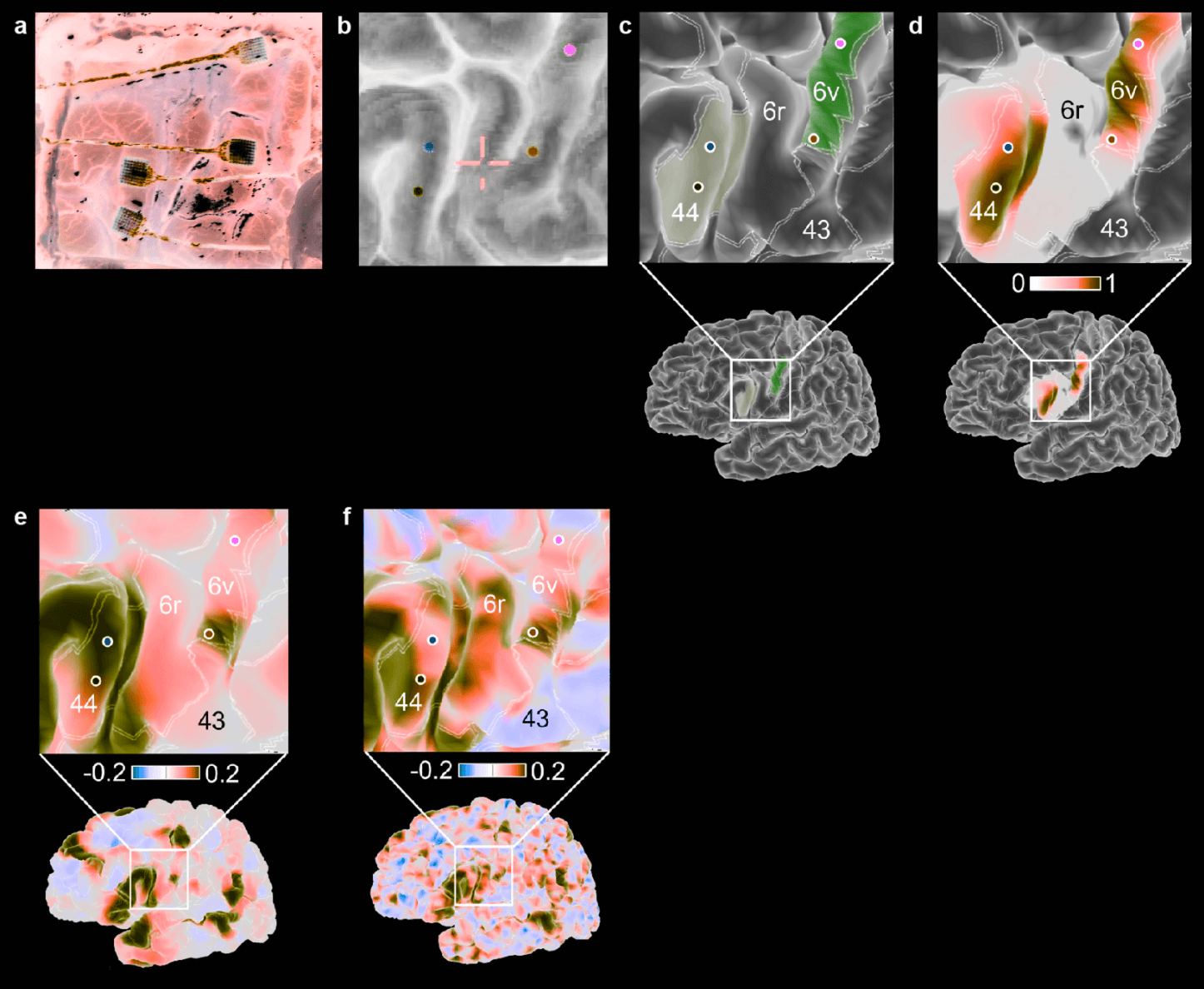 From from Willet et al 2023, implant locations clearly showing 6v