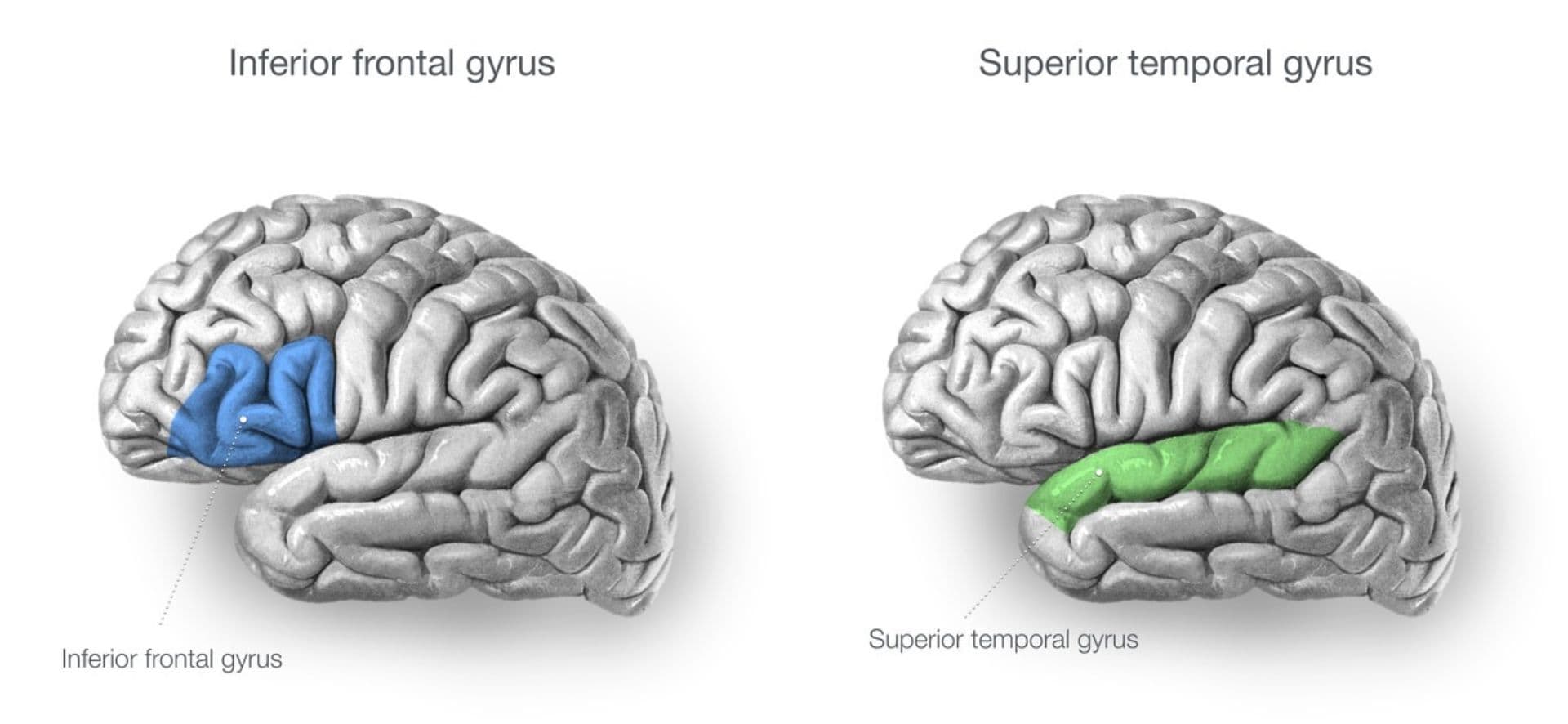 Left inferior frontal gyrus and left superior temporal gyrus
